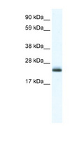 TPPP Antibody - TPPP antibody ARP37599_T100-NP_878259-2900041A09RIK Antibody Western blot of Brain lysate.  This image was taken for the unconjugated form of this product. Other forms have not been tested.