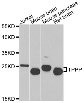 TPPP Antibody - Western blot analysis of extracts of various cells.