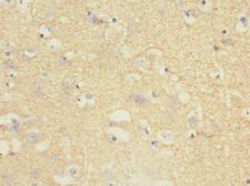 TPPP Antibody - Immunohistochemistry of paraffin-embedded human brain tissue at dilution 1:100