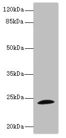 TPPP Antibody - Western blot All Lanes: TPPP antibody IgG at 1.71ug/ml+ Mouse brain tissue Secondary Goat polyclonal to rabbit IgG at 1/10000 dilution Predicted band size: 24 kDa Observed band size: 24 kDa