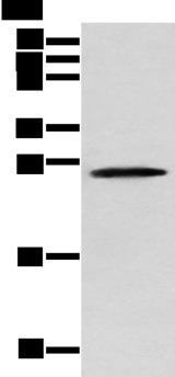 TPPP Antibody - Western blot analysis of Human fetal brain tissue  using TPPP Polyclonal Antibody at dilution of 1:250