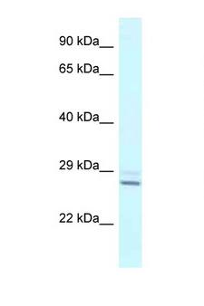 TPPP Antibody - TPPP antibody Western blot of Fetal Liver lysate. Antibody concentration 1 ug/ml.  This image was taken for the unconjugated form of this product. Other forms have not been tested.