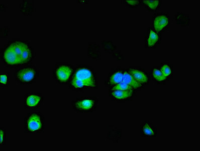 TPPP2 Antibody - Immunofluorescent analysis of MCF-7 cells using TPPP2 Antibody at dilution of 1:100 and Alexa Fluor 488-congugated AffiniPure Goat Anti-Rabbit IgG(H+L)