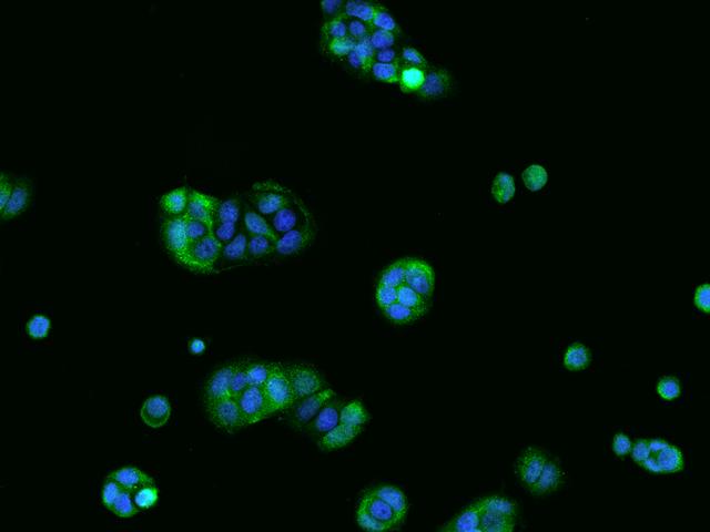 TPPP2 Antibody - Immunofluorescence staining of TPPP2 in MCF7 cells. Cells were fixed with 4% PFA, permeabilzed with 0.1% Triton X-100 in PBS, blocked with 10% serum, and incubated with rabbit anti-Human TPPP2 polyclonal antibody (dilution ratio 1:100) at 4°C overnight. Then cells were stained with the Alexa Fluor 488-conjugated Goat Anti-rabbit IgG secondary antibody (green) and counterstained with DAPI (blue). Positive staining was localized to Cytoplasm.