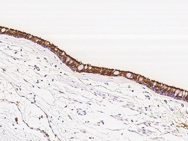 TPPP2 Antibody - Immunochemical staining of human TPPP2 in human trachea with rabbit polyclonal antibody at 1:100 dilution, formalin-fixed paraffin embedded sections.