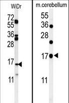 TPPP3 Antibody - (LEFT)Western blot of TPPP3 Antibody in WiDr cell tissue lysates (35 ug/lane). TPPP3 (arrow) was detected using the purified antibody.(RIGHT)Western blot of TPPP3 Antibody in mouse cerebellum tissue lysates (35 ug/lane). TPPP3 (arrow) was detected using the purified antibody.