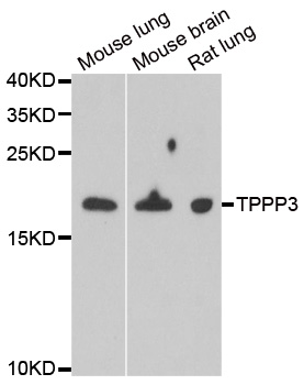 TPPP3 Antibody - Western blot analysis of extracts of various cell lines.