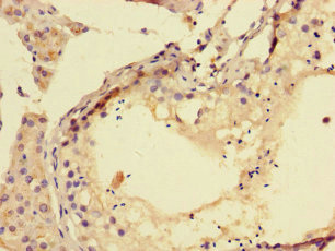 TPPP3 Antibody - Immunohistochemistry of paraffin-embedded human testis tissue using TPPP3 Antibody at dilution of 1:100