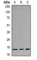 TPPP3 Antibody - Western blot analysis of TPPP3 expression in mouse lung (A); mouse brain (B); rat lung (C) whole cell lysates.