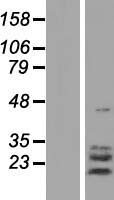 TPPP3 Protein - Western validation with an anti-DDK antibody * L: Control HEK293 lysate R: Over-expression lysate