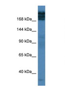TPR Antibody - TPR antibody Western blot of Fetal Lung lysate. Antibody concentration 1 ug/ml.  This image was taken for the unconjugated form of this product. Other forms have not been tested.