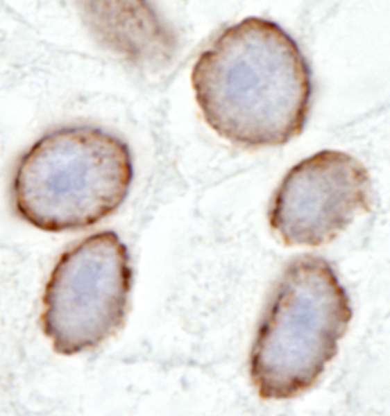 TPR Antibody - Detection of Human TPR by Immunohistochemistry. Sample: FFPE section of human testis. Antibody: Affinity purified rabbit anti-TPR used at a dilution of 1:100 (2 ug/ml). Detection: DAB.