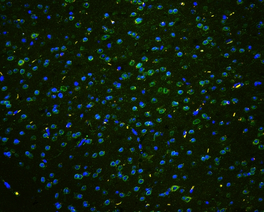 TPR Antibody - IF analysis of TPR using anti-TPR antibody TPR was detected in paraffin-embedded section of mouse brain tissues. Heat mediated antigen retrieval was performed in citrate buffer (pH6, epitope retrieval solution ) for 20 mins. The tissue section was blocked with 10% goat serum. The tissue section was then incubated with 1µg/mL rabbit anti-TPR Antibody overnight at 4°C. DyLight®488 Conjugated Goat Anti-Rabbit IgG was used as secondary antibody at 1:100 dilution and incubated for 30 minutes at 37°C. The section was counterstained with DAPI. Visualize using a fluorescence microscope and filter sets appropriate for the label used.