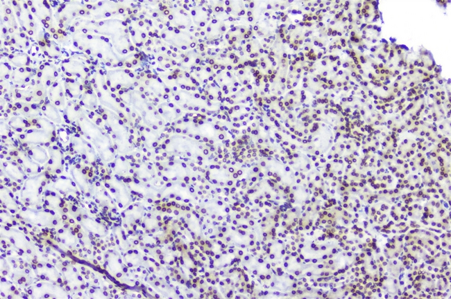 TPR Antibody - IHC analysis of TPR using anti-TPR antibody. TPR was detected in paraffin-embedded section of mouse kidney tissues. Heat mediated antigen retrieval was performed in citrate buffer (pH6, epitope retrieval solution) for 20 mins. The tissue section was blocked with 10% goat serum. The tissue section was then incubated with 1µg/ml rabbit anti-TPR Antibody overnight at 4°C. Biotinylated goat anti-rabbit IgG was used as secondary antibody and incubated for 30 minutes at 37°C. The tissue section was developed using Strepavidin-Biotin-Complex (SABC) with DAB as the chromogen.
