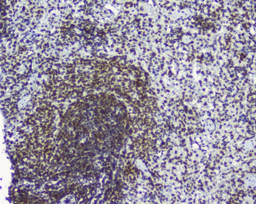 TPR Antibody - IHC analysis of TPR using anti-TPR antibody. TPR was detected in paraffin-embedded section of rat spleen tissues. Heat mediated antigen retrieval was performed in citrate buffer (pH6, epitope retrieval solution) for 20 mins. The tissue section was blocked with 10% goat serum. The tissue section was then incubated with 1µg/ml rabbit anti-TPR Antibody overnight at 4°C. Biotinylated goat anti-rabbit IgG was used as secondary antibody and incubated for 30 minutes at 37°C. The tissue section was developed using Strepavidin-Biotin-Complex (SABC) with DAB as the chromogen.
