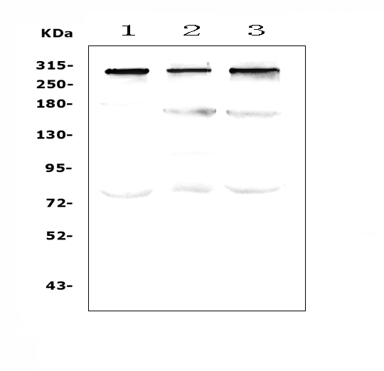 TPR Antibody - Western blot analysis of TPR using anti-TPR antibody. Electrophoresis was performed on a 5-20% SDS-PAGE gel at 70V (Stacking gel) / 90V (Resolving gel) for 2-3 hours. The sample well of each lane was loaded with 50ug of sample under reducing conditions. Lane 1: human Hela whole cell lysates,Lane 2: human SW620 whole cell lysates,Lane 3: human MDA-MB-231 whole cell lysates. After Electrophoresis, proteins were transferred to a Nitrocellulose membrane at 150mA for 50-90 minutes. Blocked the membrane with 5% Non-fat Milk/ TBS for 1.5 hour at RT. The membrane was incubated with rabbit anti-TPR antigen affinity purified polyclonal antibody at 0.5 ?g/mL overnight at 4?C, then washed with TBS-0.1% Tween 3 times with 5 minutes each and probed with a goat anti-rabbit IgG-HRP secondary antibody at a dilution of 1:10000 for 1.5 hour at RT. The signal is developed using an Enhanced Chemiluminescent detection (ECL) kit with Tanon 5200 system. A specific band was detected for TPR at approximately 300KD. The expected band size for TPR is at 267KD.
