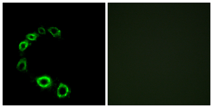 TPRA1 / GPR175 Antibody - Immunofluorescence analysis of HeLa cells, using GPR175 Antibody. The picture on the right is blocked with the synthesized peptide.