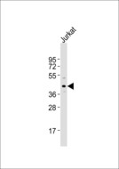 TPRA1 / GPR175 Antibody - Anti-GPR175 Antibody at 1:1000 dilution + Jurkat whole cell lysates Lysates/proteins at 20 ug per lane. Secondary Goat Anti-Rabbit IgG, (H+L),Peroxidase conjugated at 1/10000 dilution Predicted band size : 41 kDa Blocking/Dilution buffer: 5% NFDM/TBST.