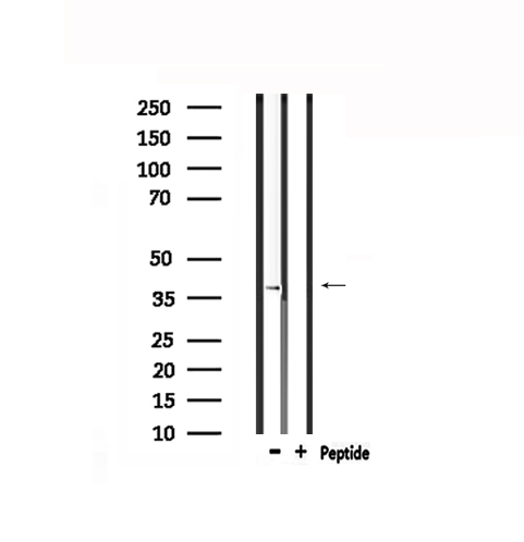TPRA1 / GPR175 Antibody