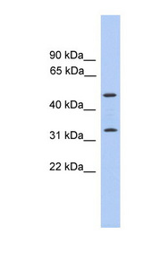 TPRG1 Antibody - TPRG1 antibody Western blot of Placenta lysate. This image was taken for the unconjugated form of this product. Other forms have not been tested.