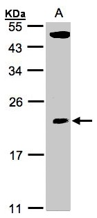 TPRKB Antibody - Sample (30 ug whole cell lysate). A:293T. 12% SDS PAGE. TPRKB antibody diluted at 1:500