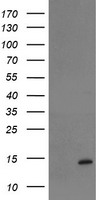 TPRKB Antibody - HEK293T cells were transfected with the pCMV6-ENTRY control (Left lane) or pCMV6-ENTRY TPRKB (Right lane) cDNA for 48 hrs and lysed. Equivalent amounts of cell lysates (5 ug per lane) were separated by SDS-PAGE and immunoblotted with anti-TPRKB.