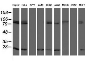 TPRKB Antibody - Western blot of extracts (35 ug) from 9 different cell lines by using g anti-TPRKB monoclonal antibody (HepG2: human; HeLa: human; SVT2: mouse; A549: human; COS7: monkey; Jurkat: human; MDCK: canine; PC12: rat; MCF7: human).