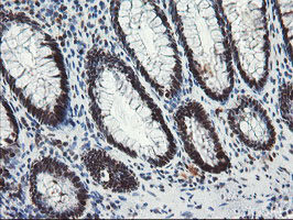TPRKB Antibody - IHC of paraffin-embedded Human colon tissue using anti-TPRKB mouse monoclonal antibody.
