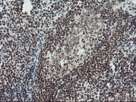 TPRKB Antibody - IHC of paraffin-embedded Human tonsil using anti-TPRKB mouse monoclonal antibody.