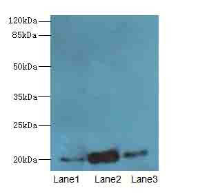 TPRKB Antibody - Western blot. All lanes: TPRKB antibody at 5 ug/ml. Lane 1: A549 whole cell lysate. Lane 2: Jurkat whole cell lysate. Lane 3: MCF7 whole cell lysate. Secondary Goat polyclonal to Rabbit IgG at 1:10000 dilution. Predicted band size: 20 kDa. Observed band size: 20 kDa.