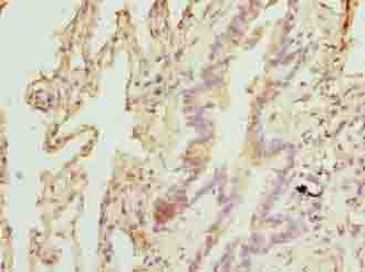 TPRKB Antibody - Immunohistochemistry of paraffin-embedded human lung tissue using antibody at dilution of 1:100.