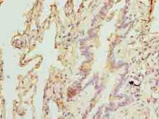 TPRKB Antibody - Immunohistochemistry of paraffin-embedded human lung tissue using antibody at dilution of 1:100.