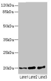 TPRKB Antibody - Western blot All lanes: TPRKB antibody at 5µg/ml Lane 1: A549 whole cell lysate Lane 2: Jurkat whole cell lysate Lane 3: MCF-7 whole cell lysate Secondary Goat polyclonal to rabbit IgG at 1/10000 dilution Predicted band size: 20, 17, 24 kDa Observed band size: 20 kDa