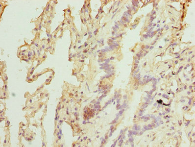 TPRKB Antibody - Immunohistochemistry of paraffin-embedded human lung tissue using TPRKB Antibody at dilution of 1:100