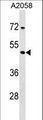 TPRX1 Antibody - TPRX1 Antibody western blot of A2058 cell line lysates (35 ug/lane). The TPRX1 antibody detected the TPRX1 protein (arrow).