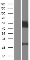 TPRX1 Protein - Western validation with an anti-DDK antibody * L: Control HEK293 lysate R: Over-expression lysate