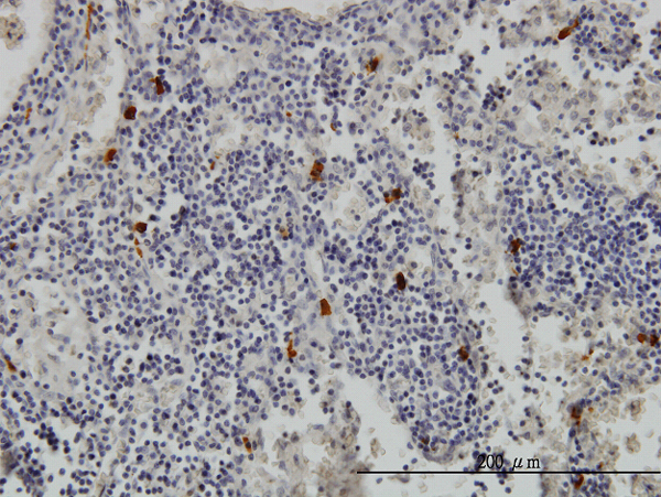 TPSAB1 / Mast Cell Tryptase Antibody - Immunoperoxidase of monoclonal antibody to TPSAB1 on formalin-fixed paraffin-embedded human lymph node (antibody concentration 1 ug/ml).