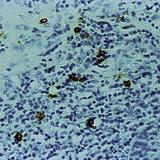 TPSAB1 / Mast Cell Tryptase Antibody - Formalin-fixed, paraffin-embedded human tonsil stained with Mast Cell Tryptase antibody.