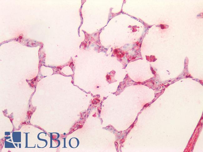 TPSAB1 / Mast Cell Tryptase Antibody - Human Lung: Formalin-Fixed, Paraffin-Embedded (FFPE)