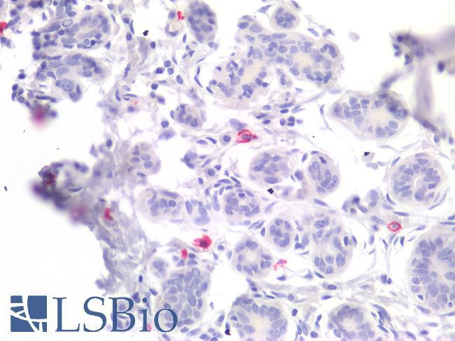 TPSAB1 / Mast Cell Tryptase Antibody - Human Breast, Mast Cells: Formalin-Fixed, Paraffin-Embedded (FFPE)