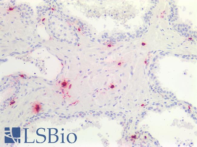 TPSAB1 / Mast Cell Tryptase Antibody - Human Prostate, Mast Cells: Formalin-Fixed, Paraffin-Embedded (FFPE)