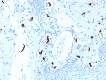 TPSAB1 / Mast Cell Tryptase Antibody - IHC testing of FFPE human tonsil tissue with TPSAB1 antibody (clone TPSAB1/1961). HIER: boil tissue sections in pH6, 10mM citrate buffer, for 10-20 min followed by cooling at RT for 20 min.