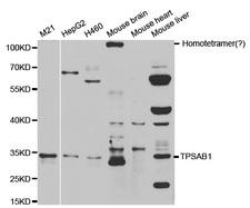 TPSAB1 / Mast Cell Tryptase Antibody - Western blot analysis of extracts of various cell lines.