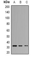 TPSAB1 / Mast Cell Tryptase Antibody - Western blot analysis of Tryptase alpha/beta expression in HepG2 (A); mouse brain (B); mouse liver (C) whole cell lysates.