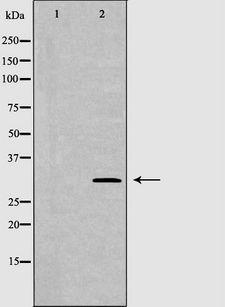 TPSAB1 / Mast Cell Tryptase Antibody - Western blot analysis of mouse lung lysate using TPSAB1 antibody. The lane on the left is treated with the antigen-specific peptide.