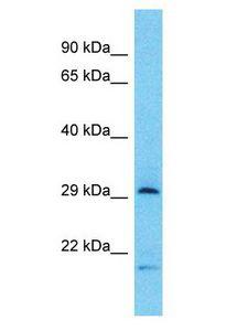 Tpsb2 / Tryptase Beta 2 (Mouse Antibody - TPSB2 / Tryptase Beta 2 antibody Western Blot of HT1080. Antibody dilution: 1 ug/ml.  This image was taken for the unconjugated form of this product. Other forms have not been tested.