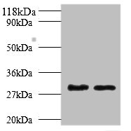 Tpsb2 / Tryptase Beta 2 (Mouse Antibody - Western blot All lanes: Tpsb2 antibody at 2µg/ml Lane 1: Mouse heart tissue Lane 2: Rat heart tissue Secondary Goat polyclonal to rabbit IgG at 1/10000 dilution Predicted band size: 31, 26 kDa Observed band size: 31 kDa