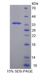 Tpsb2 / Tryptase Beta 2 (Mouse Protein - Recombinant  Tryptase Beta 2 By SDS-PAGE