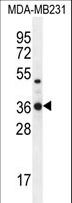 TPSD1 / Tryptase Delta 1 Antibody - TPSD1 Antibody western blot of MDA-MB231 cell line lysates (35 ug/lane). The TPSD1 antibody detected the TPSD1 protein (arrow).