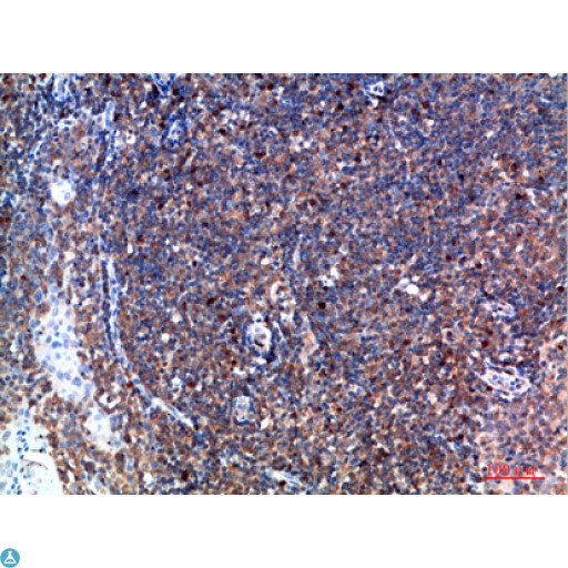 TPSD1 / Tryptase Delta 1 Antibody - Immunohistochemical analysis of paraffin-embedded human-tonsil, antibody was diluted at 1:200.